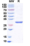 Recombinant Human PNMT Protein, N-His