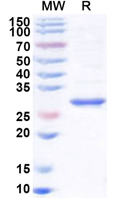 Recombinant Human PNMT Protein, N-His