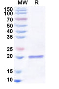 Recombinant Human RPS17 Protein, N-His