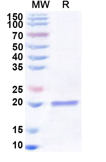 Recombinant Human RPS17 Protein, N-His