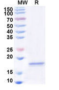 Recombinant Human LY86 Protein, N-His