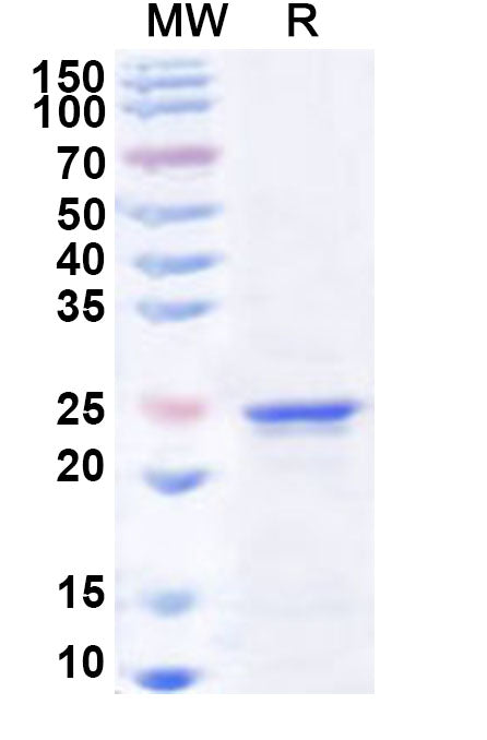 Recombinant Human SIX6 Protein, N-His
