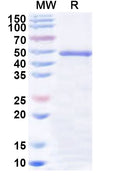 Recombinant Human GCAT Protein, N-His