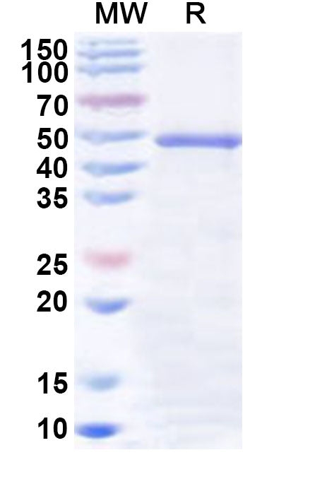 Recombinant Human GCAT Protein, N-His