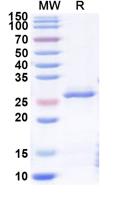 Recombinant Human NR2F1 Protein, N-His
