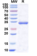 Recombinant Human LDHC Protein, N-His