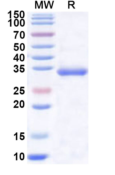 Recombinant Human LDHC Protein, N-His