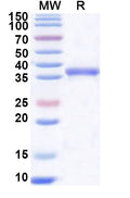 Recombinant Human USP48 Protein, N-His