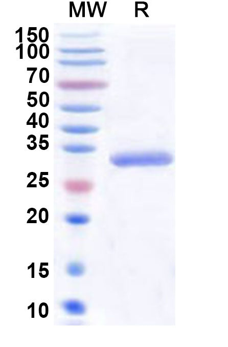 Recombinant Human PRKACG Protein, N-His