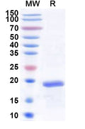 Recombinant Human LMO1 Protein, N-His