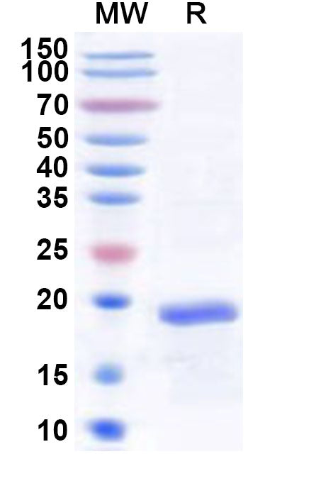 Recombinant Human LMO1 Protein, N-His