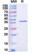 Recombinant Human RASSF2 Protein, N-His