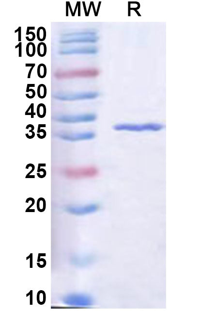 Recombinant Human RASSF2 Protein, N-His