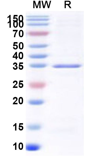 Recombinant Human RBMY1B Protein, N-GST & C-His