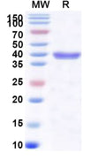 Recombinant Human CHMP4B Protein, N-His-SUMO&C-Strep