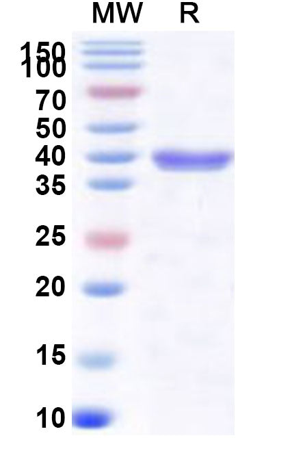 Recombinant Human CHMP4B Protein, N-His-SUMO&C-Strep