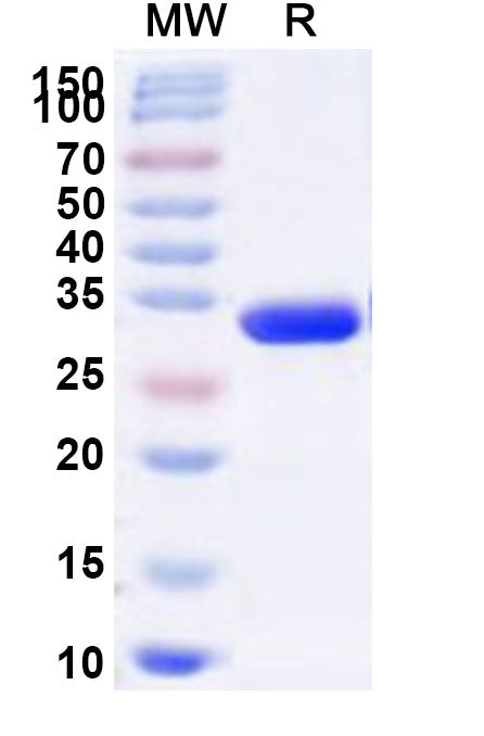 Recombinant Human RPS4X Protein, N-His