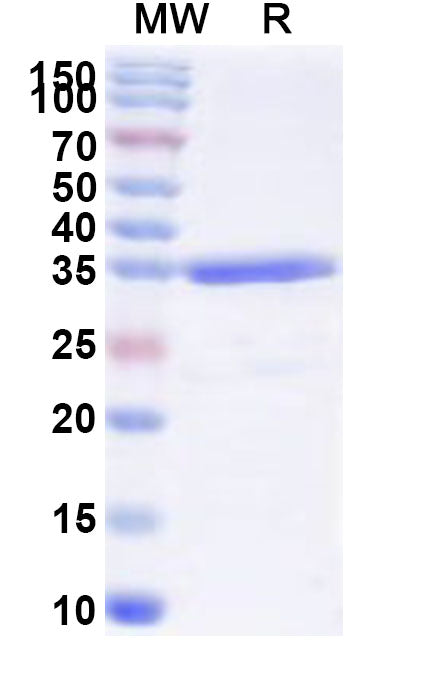 Recombinant Human TOX3 Protein, N-GST & C-His