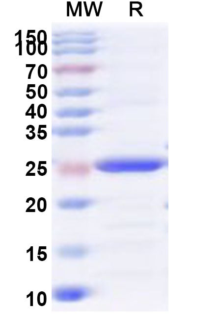 Recombinant Human CSTF2 Protein, N-His