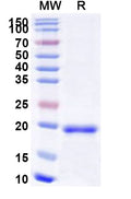 Recombinant Human RNF113A Protein, N-His