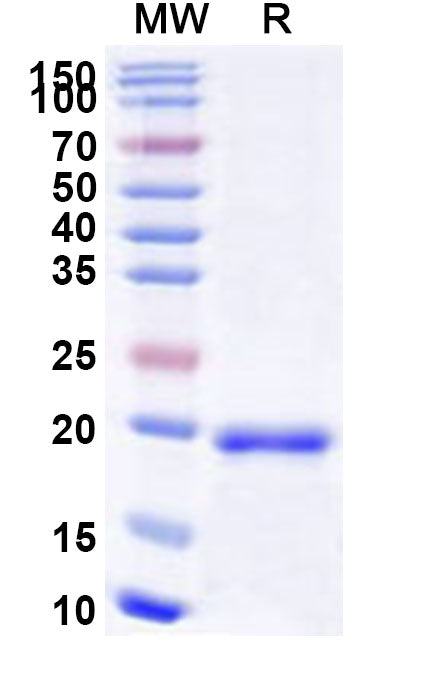 Recombinant Human RNF113A Protein, N-His