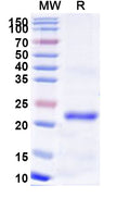 Recombinant Human MEFV Protein, N-His