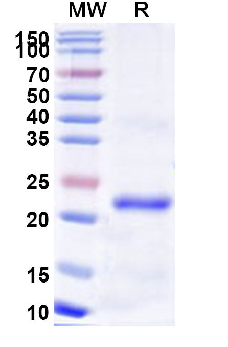 Recombinant Human MEFV Protein, N-His