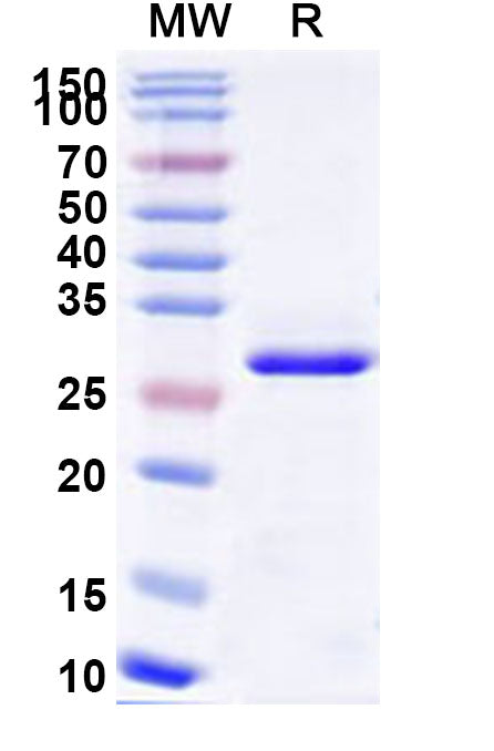 Recombinant Human MRAS Protein, N-His