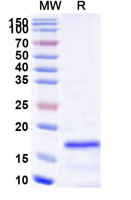 Recombinant Human SAP18 Protein, N-His