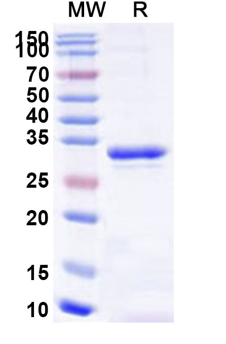 Recombinant Human SEC16A Protein, N-His