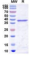 Recombinant Human RNMT Protein, N-His