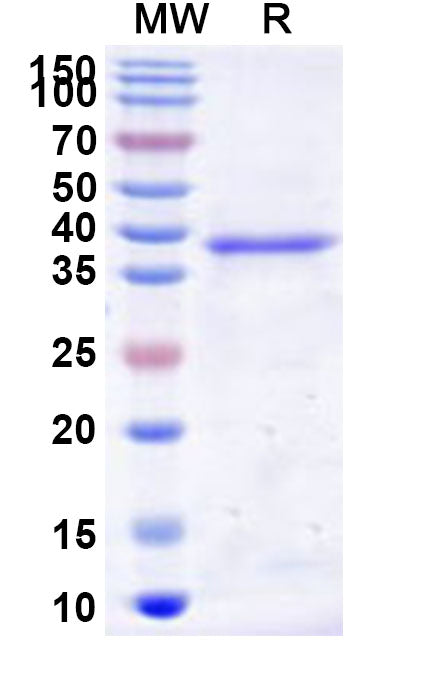 Recombinant Human RNMT Protein, N-His