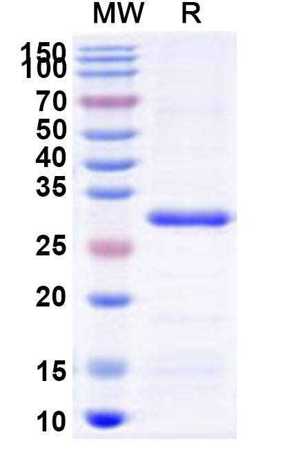Recombinant Human HR Protein, N-His