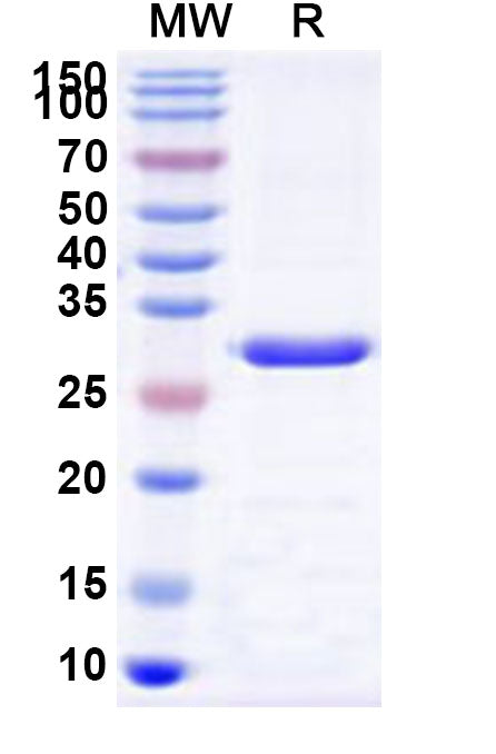 Recombinant Human SLC26A4 Protein, N-His