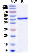Recombinant Human ORC4 Protein, N-His