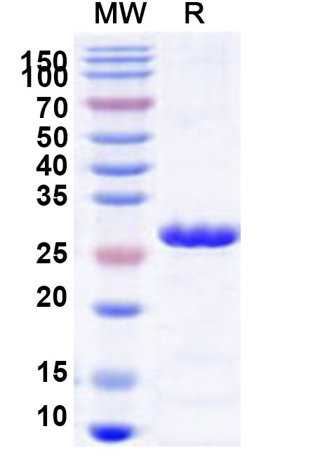 Recombinant Human TBC1D4 Protein, N-His