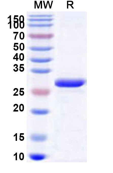 Recombinant Human ATP8B3 Protein, N-His