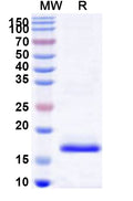Recombinant Human CYTIP Protein, N-His