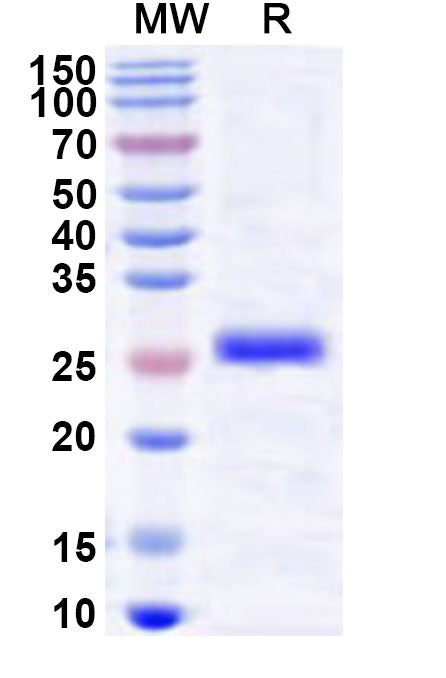 Recombinant Human LDB3 Protein, N-His