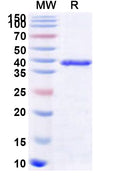 Recombinant Human USP12 Protein, N-His
