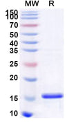 Recombinant Human ARHGEF15 Protein, N-His