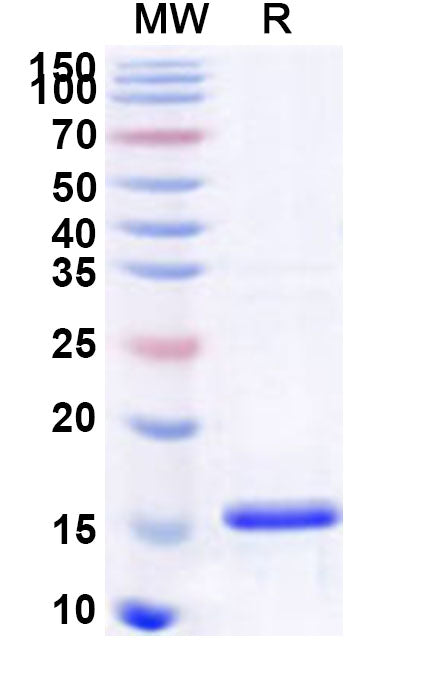 Recombinant Human ARHGEF15 Protein, N-His