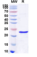 Recombinant Human SAP30 Protein, N-His