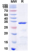 Recombinant Human TBKBP1 Protein, N-GST & C-His