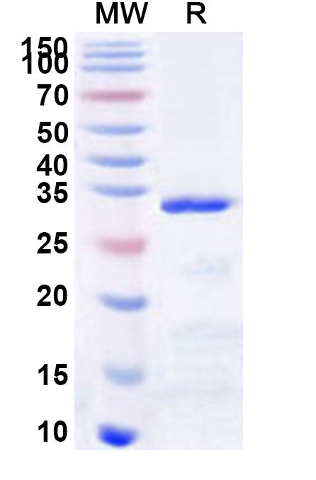 Recombinant Human TBKBP1 Protein, N-GST & C-His