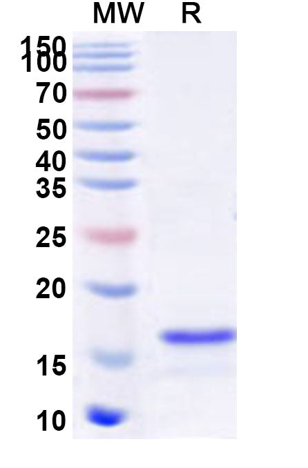 Recombinant Human ZNF217 Protein, N-His