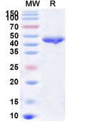Recombinant Human PAPSS2 Protein, N-His