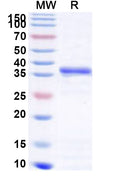 Recombinant Human GNAI2 Protein, N-His