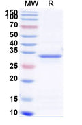 Recombinant Human SBK3 Protein, N-His