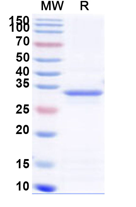 Recombinant Human SBK3 Protein, N-His